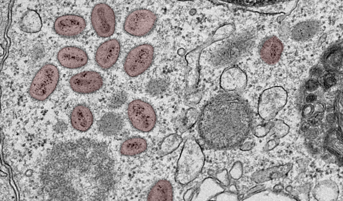 UFMG recebe recursos para pesquisa sobre o vírus da varíola dos macacos