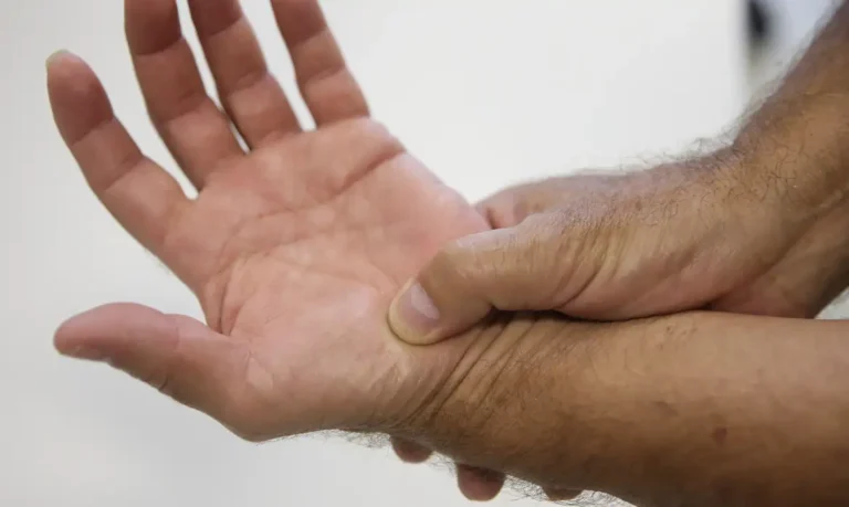 Lúpus: conheça os sintomas e cuidados com a doença