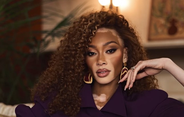 Vitiligo: doença não é contagiosa e causa ainda é desconhecida
