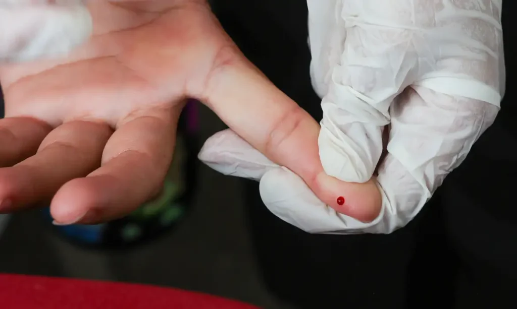 Brasil atinge meta de redução da transmissão vertical de hepatite B