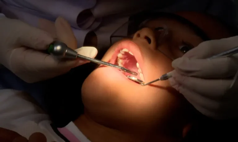 Gengivite: doença pode ser evitada com limpeza adequada dos dentes